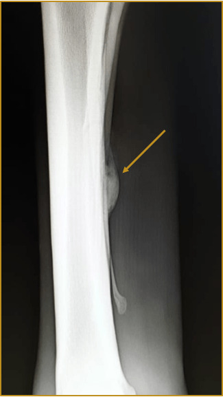 Überbeine beim Pferd