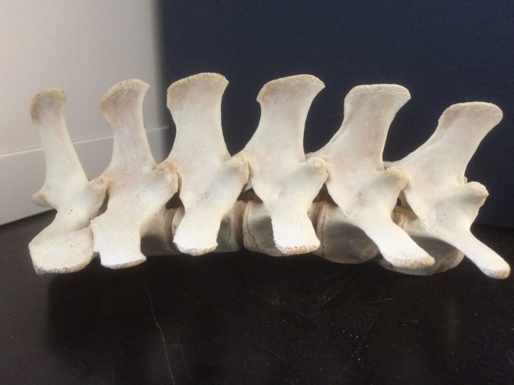 Lendenwirbelsäule-mit -Querfortsätzen